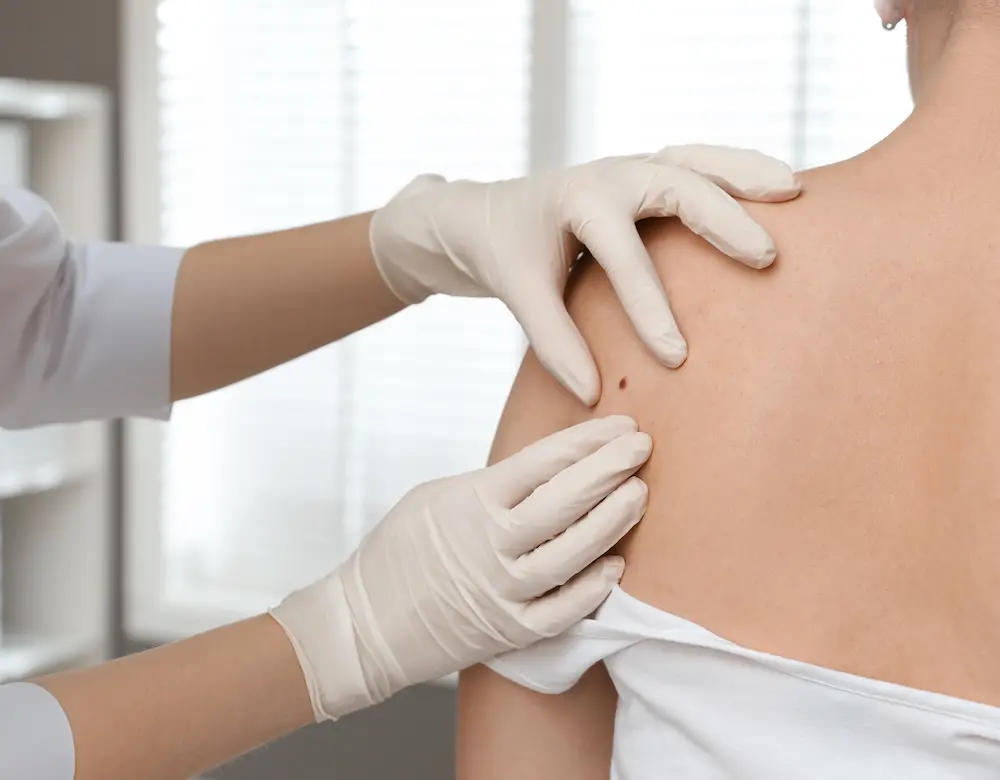 Dermatologie und Hautkrebs