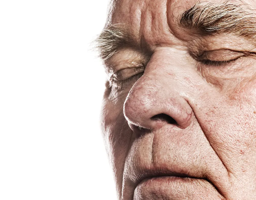 Knollennase Knollennase